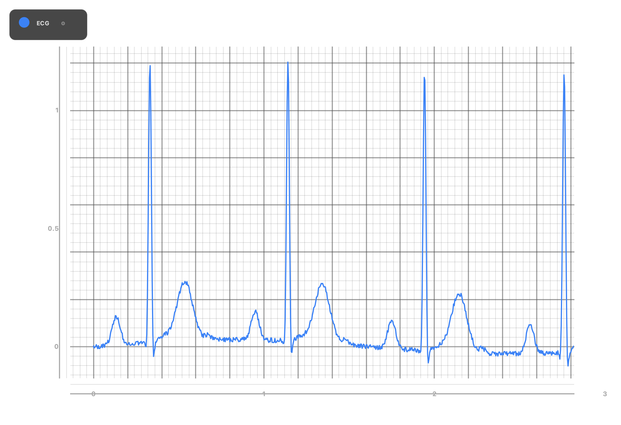 ECG waveform