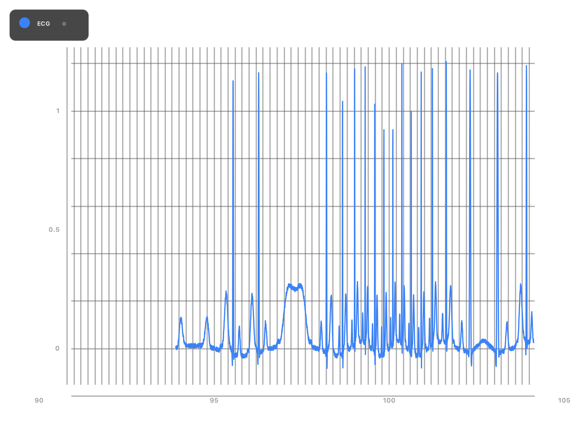 ECG monitoring